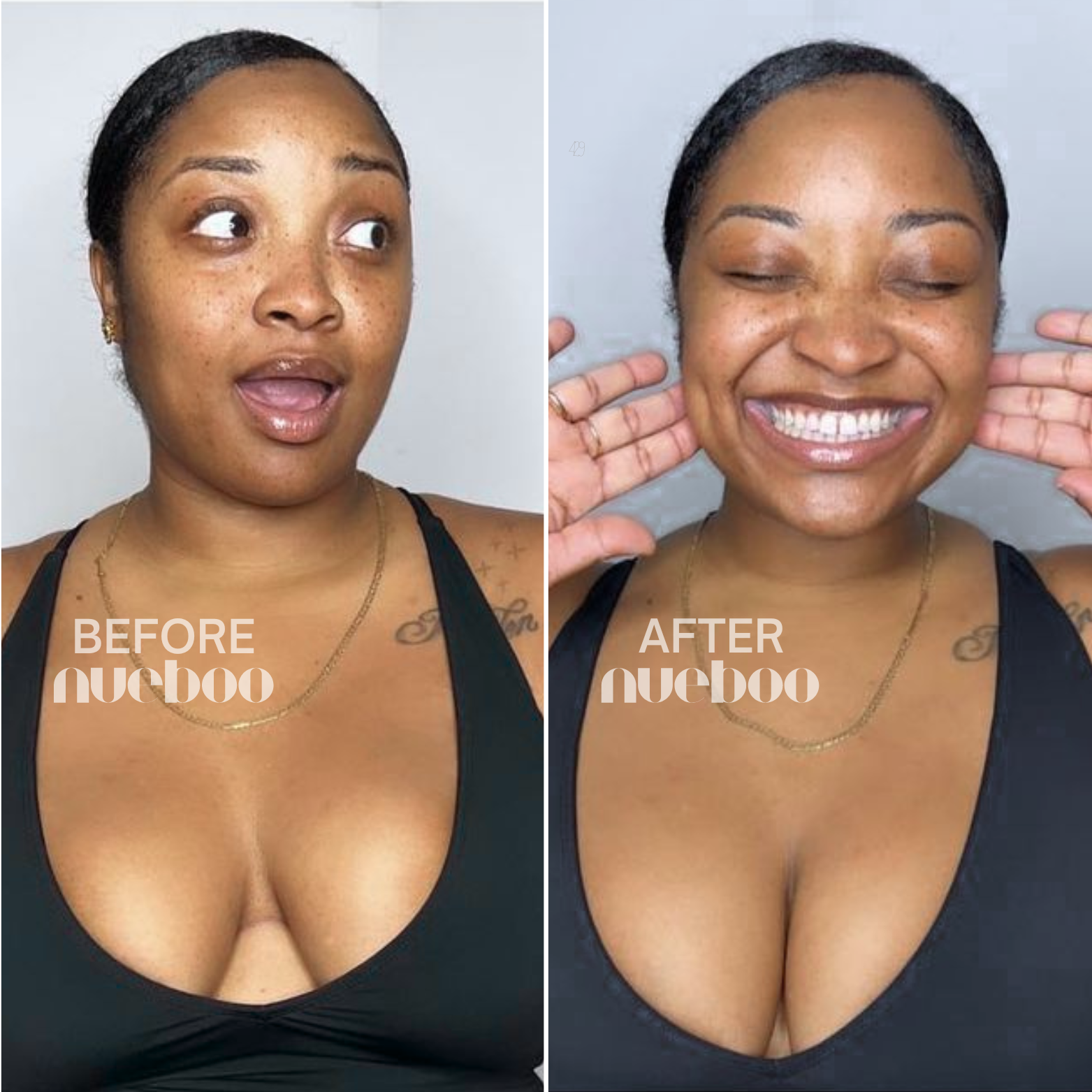 Breast Lift Tape Easy Lift Adhesive Bra - 3 Pairs – Nueboo